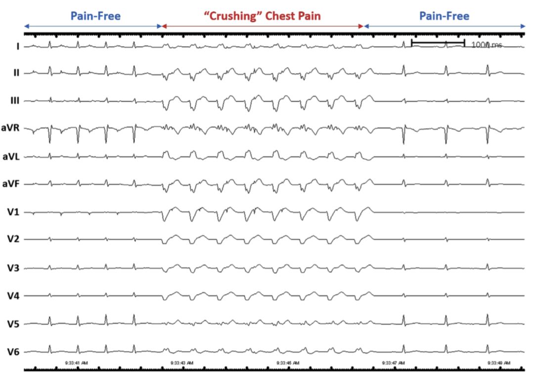 疼痛性神经痛怎么治疗,疼痛神经阻滞教程