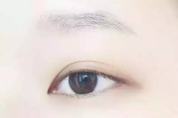 从眉毛看出疾病的征兆,小孩掉眉毛可能是大病预兆