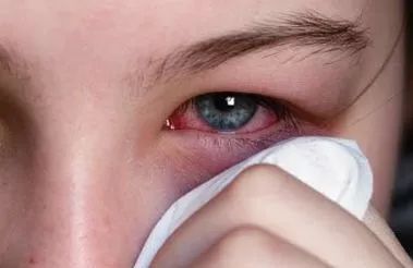 睫毛一定要翘才好看吗,睫毛一定要补吗