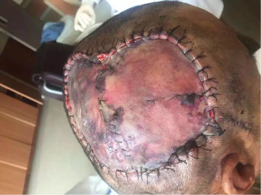 清华长庚血管外科,北京清华长庚医院治疗脑肿瘤好吗