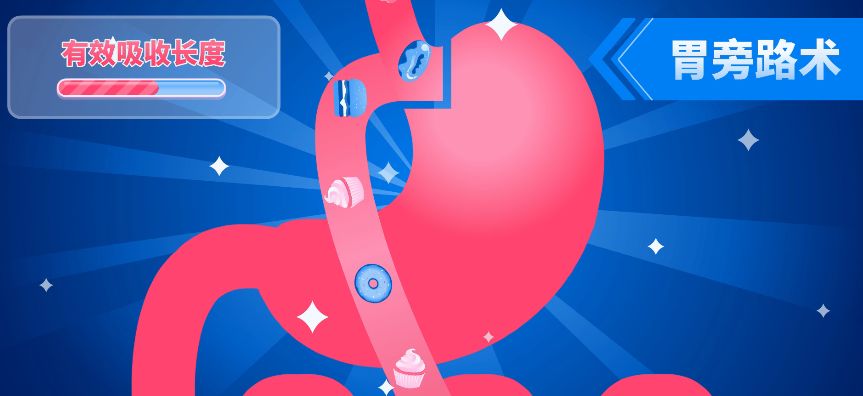 切胃真的能瘦吗,切胃减肥不就是节食吗