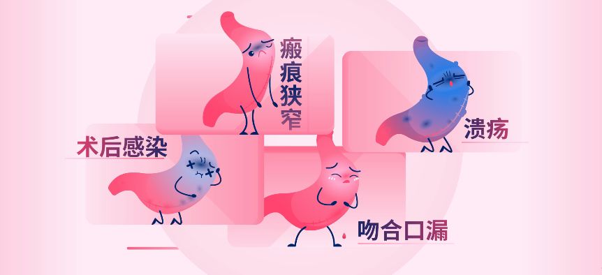 切胃真的能瘦吗,切胃减肥不就是节食吗