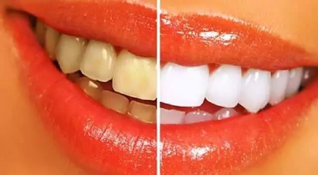 能刷牙缝去牙渍的手动牙刷,超细软牙刷深层清洁软毛牙刷