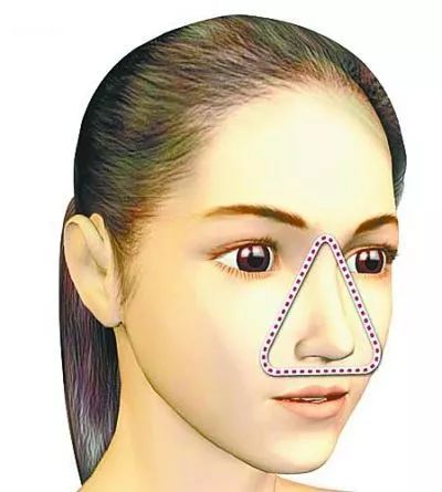 千万别乱挤痘痘一不小心就进了icu,挤掉痘痘后留了个洞