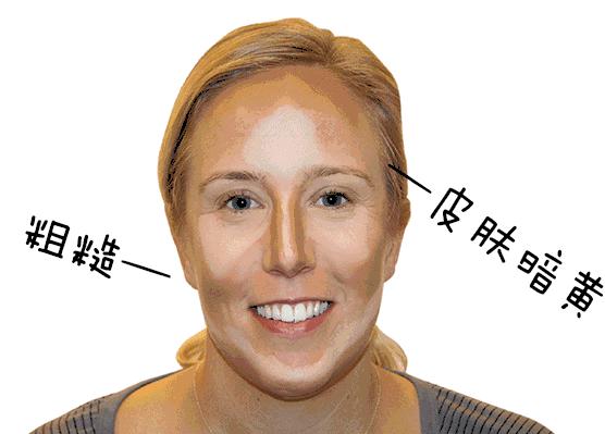 小茂肌诊室∣为什么拼命补水好多年，皮肤还是没变好？