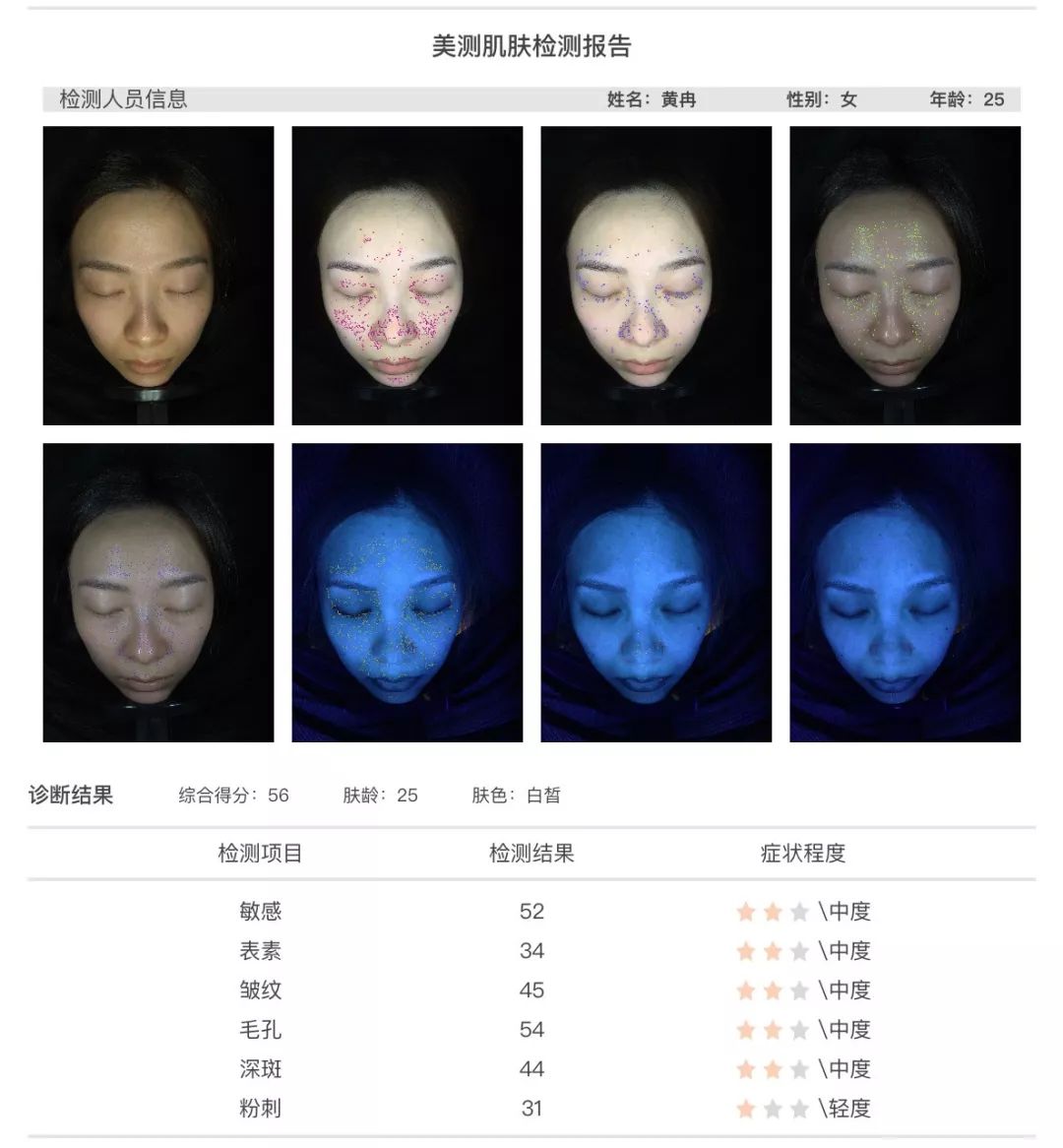 小茂肌诊室∣为什么拼命补水好多年，皮肤还是没变好？