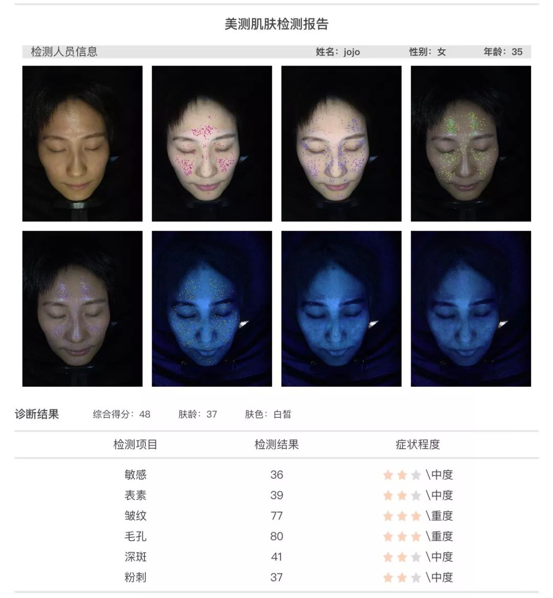 小茂肌诊室∣为什么拼命补水好多年，皮肤还是没变好？