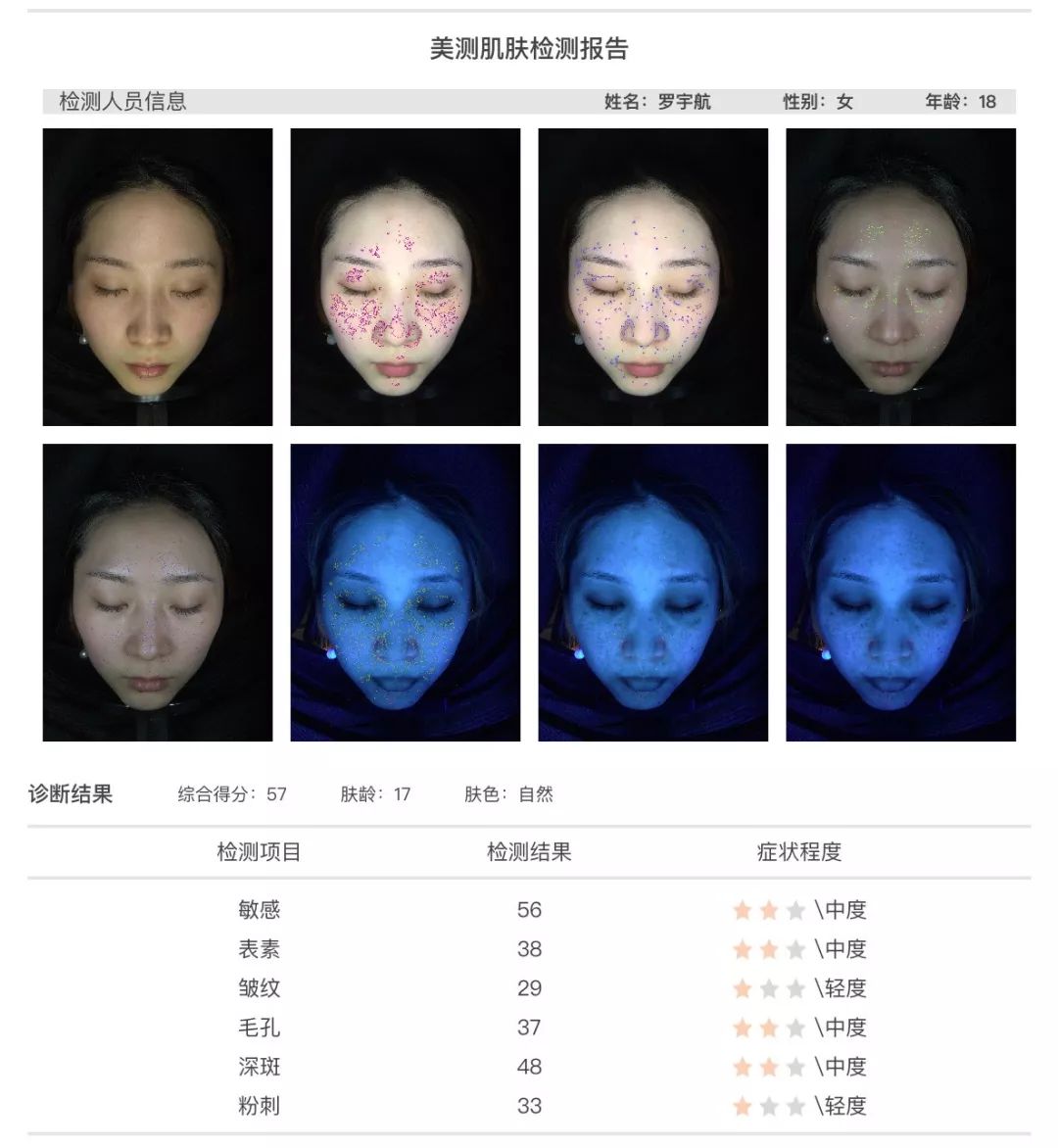 小茂肌诊室∣为什么拼命补水好多年，皮肤还是没变好？