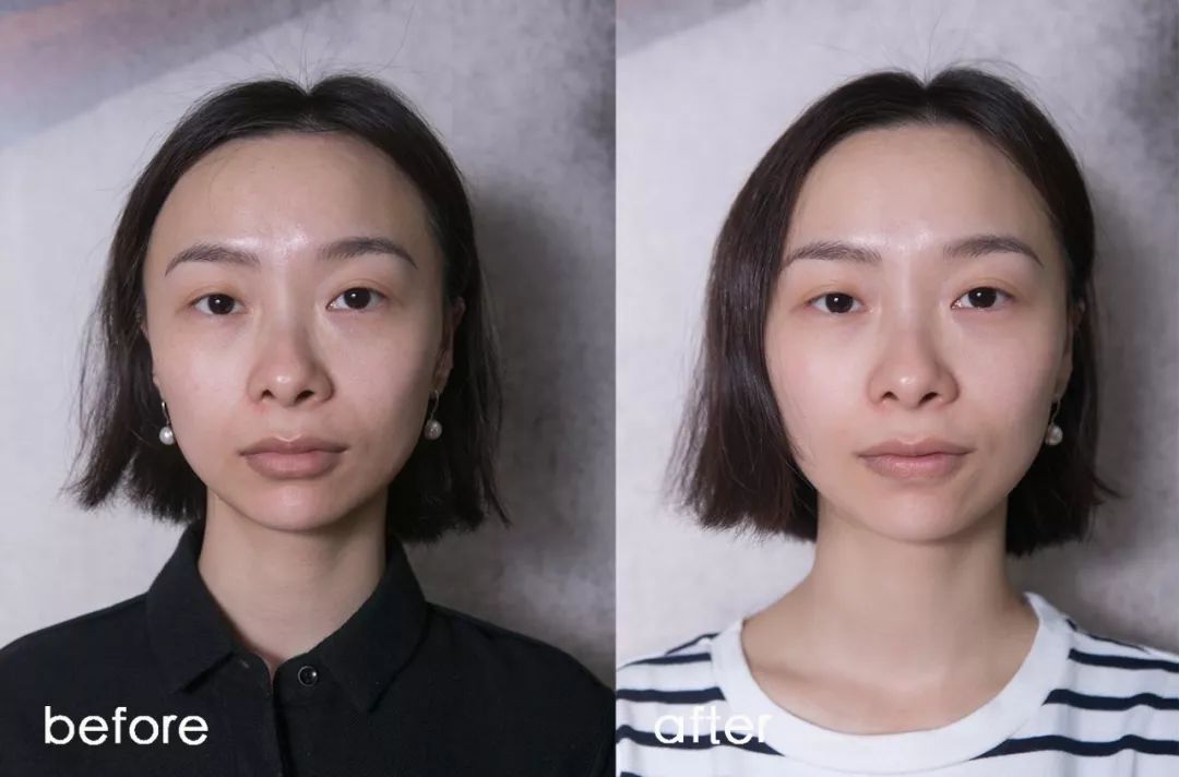 小茂肌诊室∣为什么拼命补水好多年，皮肤还是没变好？