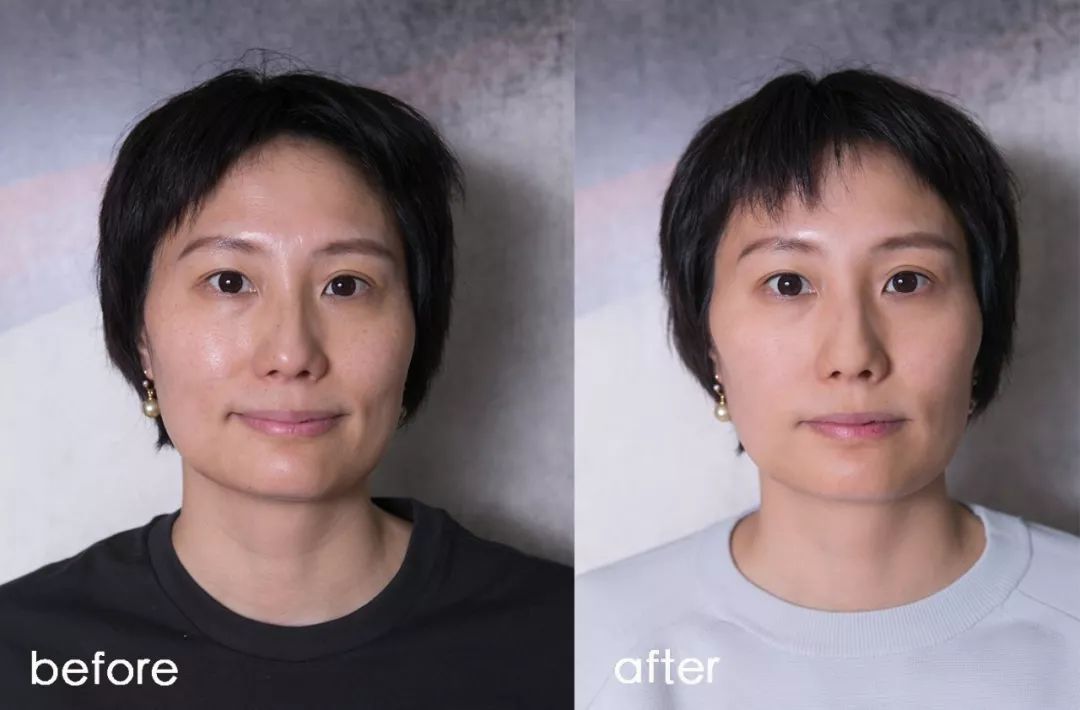 小茂肌诊室∣为什么拼命补水好多年，皮肤还是没变好？