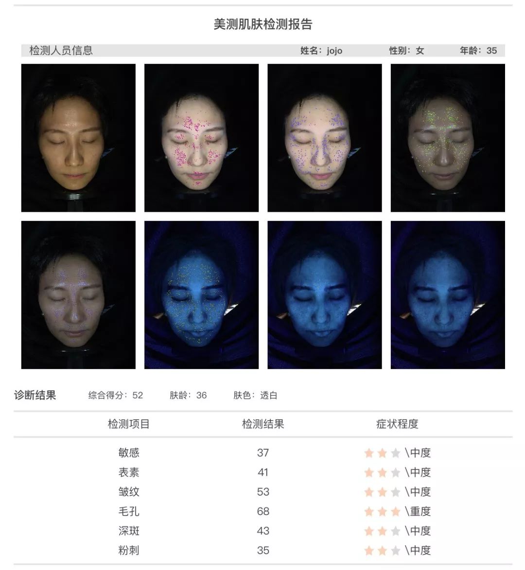 小茂肌诊室∣为什么拼命补水好多年，皮肤还是没变好？