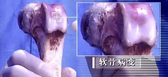 更年期全身关节咔咔响是怎么回事,50岁女全身关节咔咔响怎么调理