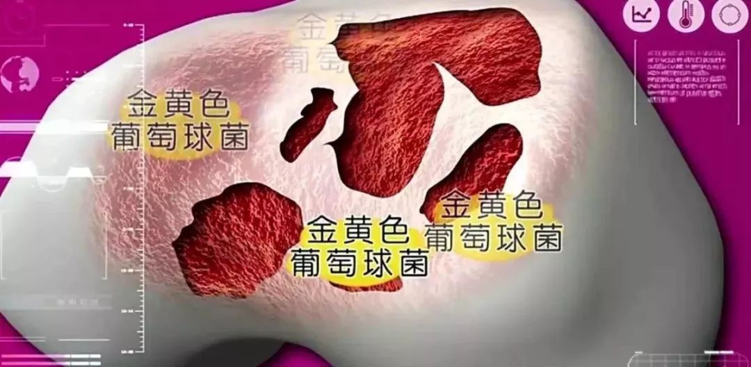 更年期全身关节咔咔响是怎么回事,50岁女全身关节咔咔响怎么调理