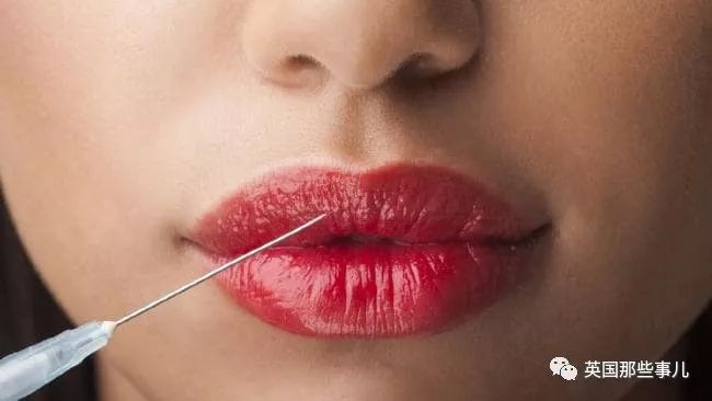 丰唇后肿成香肠嘴过几天会消失吗,在朋友家里玩香肠派对