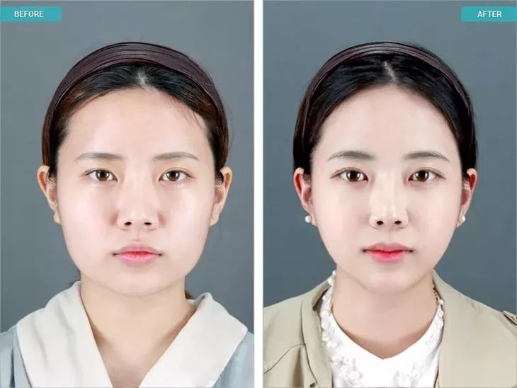 【精选好物】滚一滚,全身缩水小一圈!明星都爱的淋巴按摩仪,滚出小蛮腰、小V脸