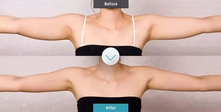 【精选好物】滚一滚,全身缩水小一圈!明星都爱的淋巴按摩仪,滚出小蛮腰、小V脸