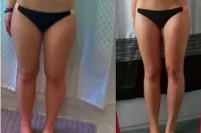 【精选好物】滚一滚,全身缩水小一圈!明星都爱的淋巴按摩仪,滚出小蛮腰、小V脸