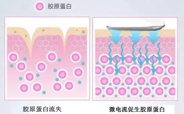 【精选好物】滚一滚,全身缩水小一圈!明星都爱的淋巴按摩仪,滚出小蛮腰、小V脸