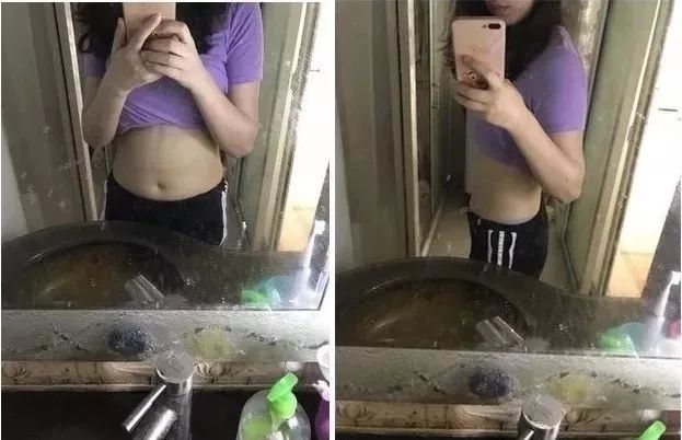 【精选好物】滚一滚，全身缩水小一圈！明星都爱的淋巴按摩仪，滚出小蛮腰、小V脸