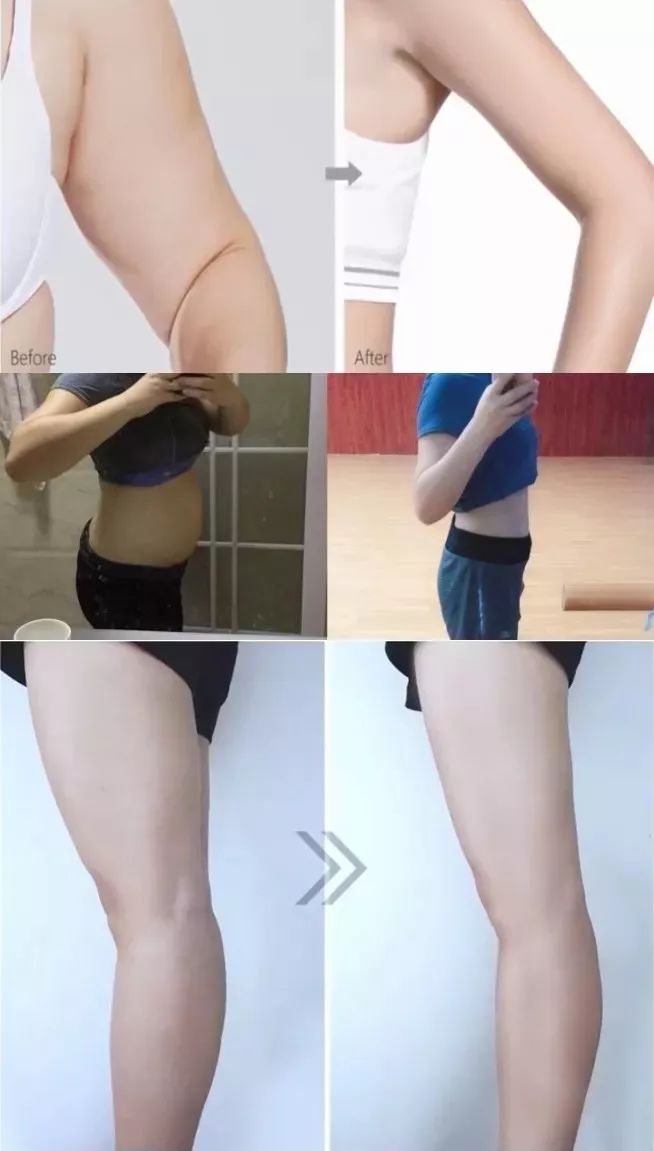 【精选好物】滚一滚,全身缩水小一圈!明星都爱的淋巴按摩仪,滚出小蛮腰、小V脸