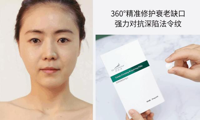 杨紫法令纹填充过多像小猴子,杨紫法令纹和嘴角纹怎么这么深