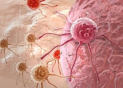 癌症遗传史可以避免吗,没得癌症遗传史会得癌症吗