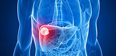 癌症遗传史可以避免吗,没得癌症遗传史会得癌症吗