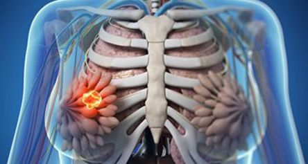 癌症遗传史可以避免吗,没得癌症遗传史会得癌症吗