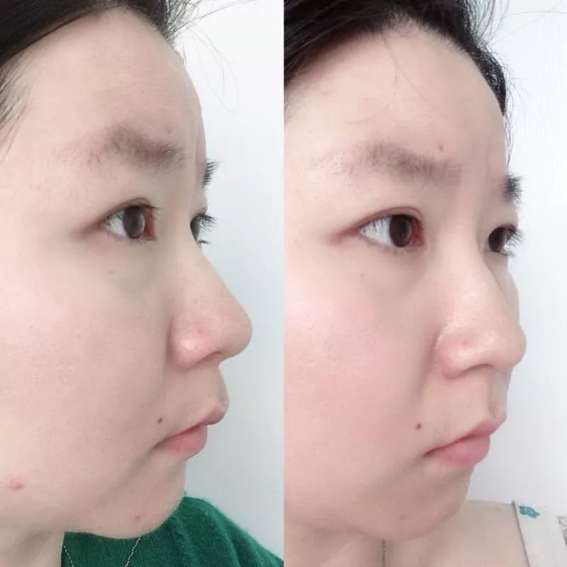 盲测14天揭密|年轻肌特训营收关，那瓶好评如潮的精华水究竟是谁？