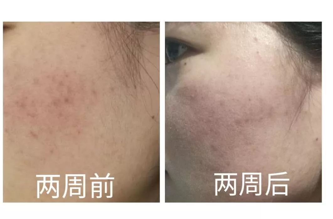 盲测14天揭密|年轻肌特训营收关，那瓶好评如潮的精华水究竟是谁？