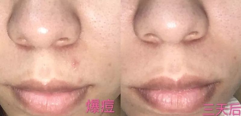 盲测14天揭密|年轻肌特训营收关，那瓶好评如潮的精华水究竟是谁？