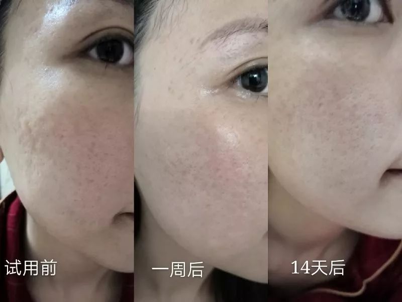 盲测14天揭密|年轻肌特训营收关，那瓶好评如潮的精华水究竟是谁？