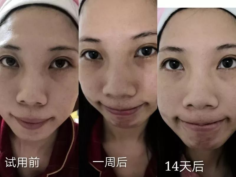 盲测14天揭密|年轻肌特训营收关，那瓶好评如潮的精华水究竟是谁？