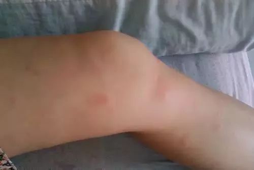 不用喂药!不用追!轻轻喷在它们的必经之路,就能瞬间“制服”!