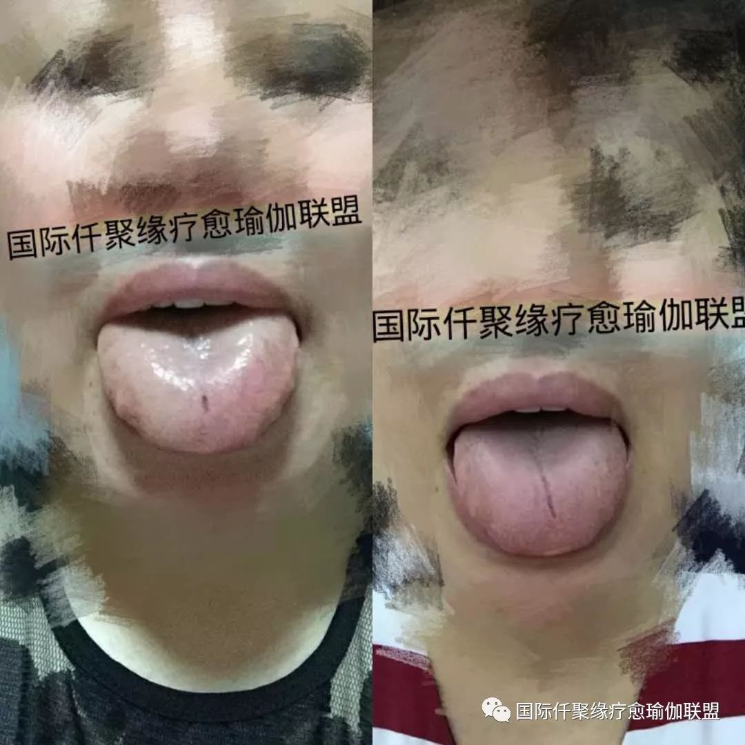 阿育吠陀瑜伽课程,阿育吠陀瑜伽培训班