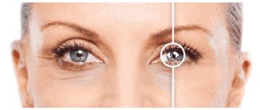 德国变态震动棒,啪啪啪间抚平眼袋、黑眼圈!不用开刀,就能让你年轻十岁!