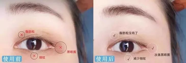 德国变态震动棒,啪啪啪间抚平眼袋、黑眼圈!不用开刀,就能让你年轻十岁!