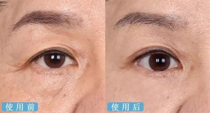 德国变态震动棒,啪啪啪间抚平眼袋、黑眼圈!不用开刀,就能让你年轻十岁!