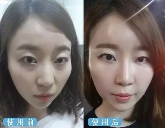 德国变态震动棒，啪啪啪间抚平眼袋、黑眼圈！不用开刀，就能让你年轻十岁！