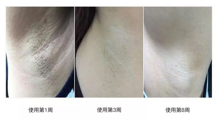 这个夏天变美小技巧,夏天怎么变得越来越美