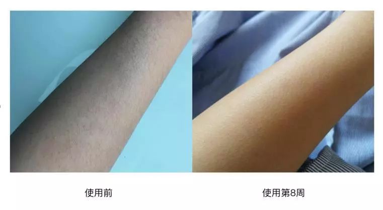 这个夏天变美小技巧,夏天怎么变得越来越美