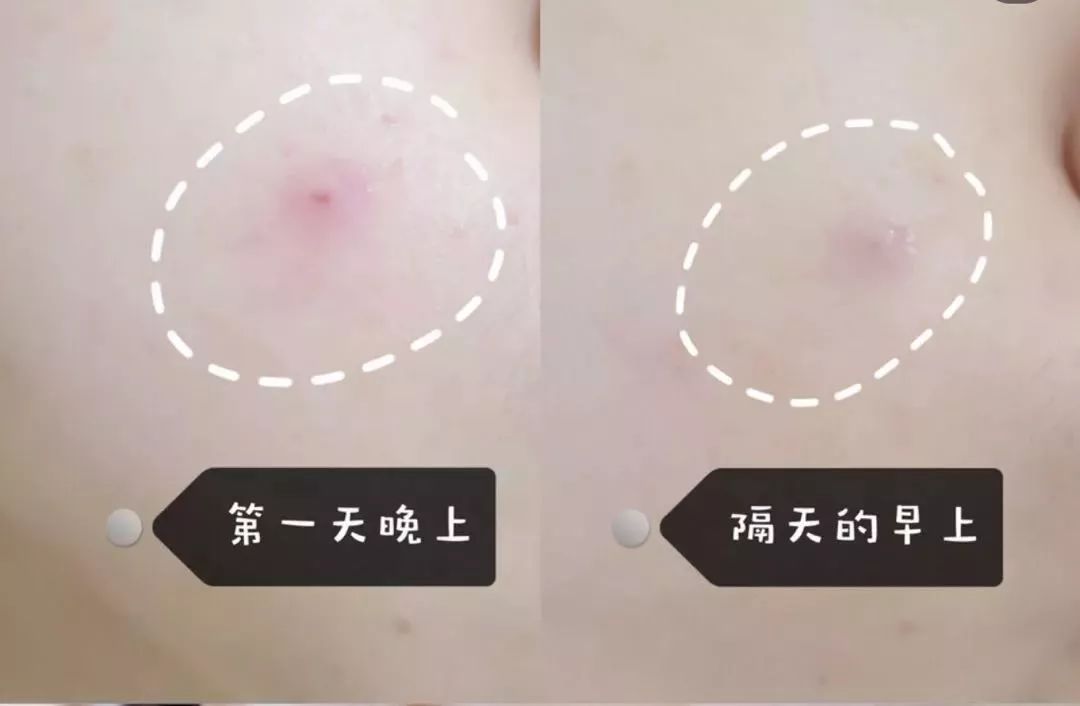 品牌面膜抗皱紧致抗衰老正品,中药面膜抗皱紧致补水正品老牌子