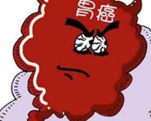 什么是胃癌肿瘤免疫治疗,胃癌预防宣传知识