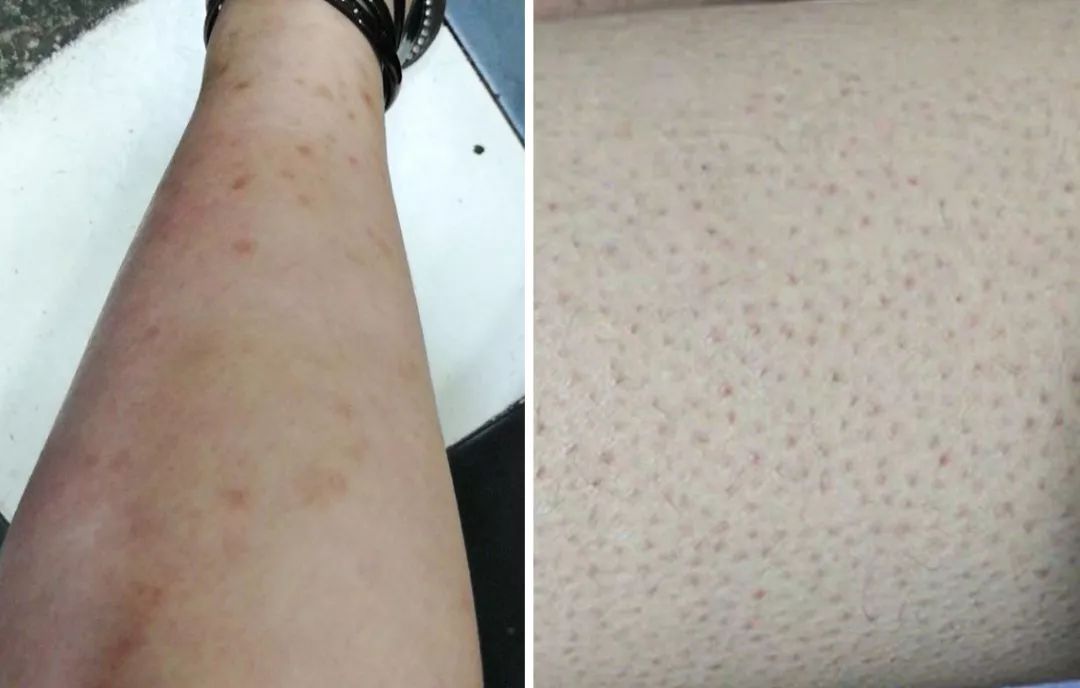 裸感美腿|1瓶=20双*袜丝**!3秒喷出“裸感”大美腿!隐形毛孔、鸡皮肤!短裙绝配