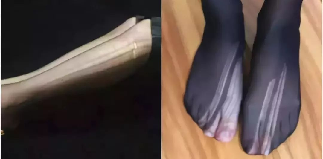 裸感美腿|1瓶=20双*袜丝**!3秒喷出“裸感”大美腿!隐形毛孔、鸡皮肤!短裙绝配