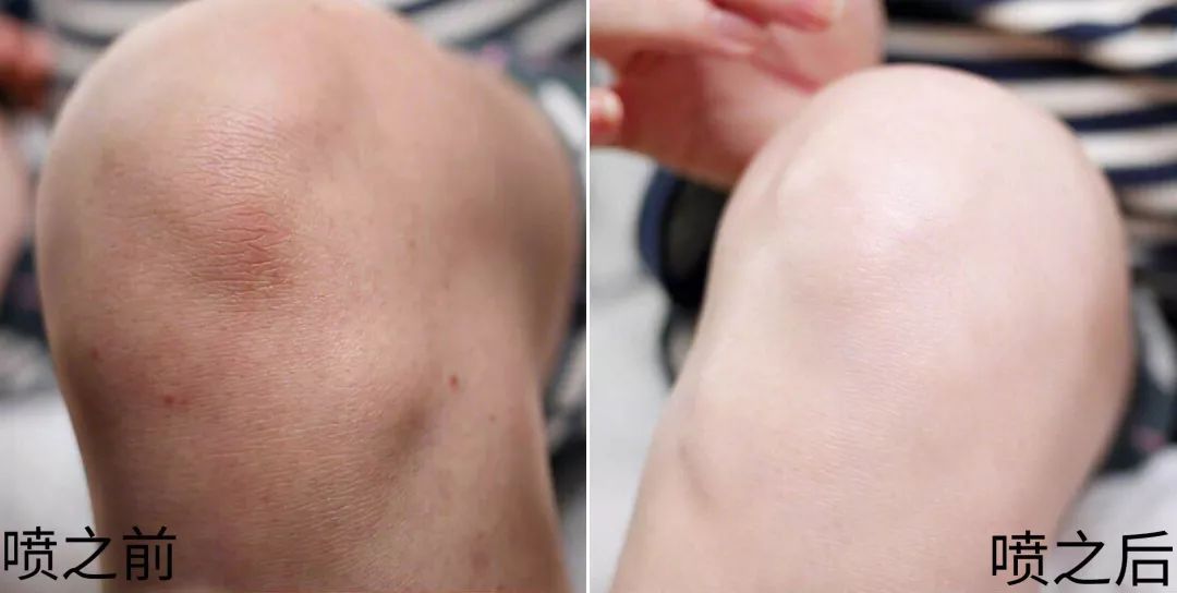 裸感美腿|1瓶=20双*袜丝**!3秒喷出“裸感”大美腿!隐形毛孔、鸡皮肤!短裙绝配