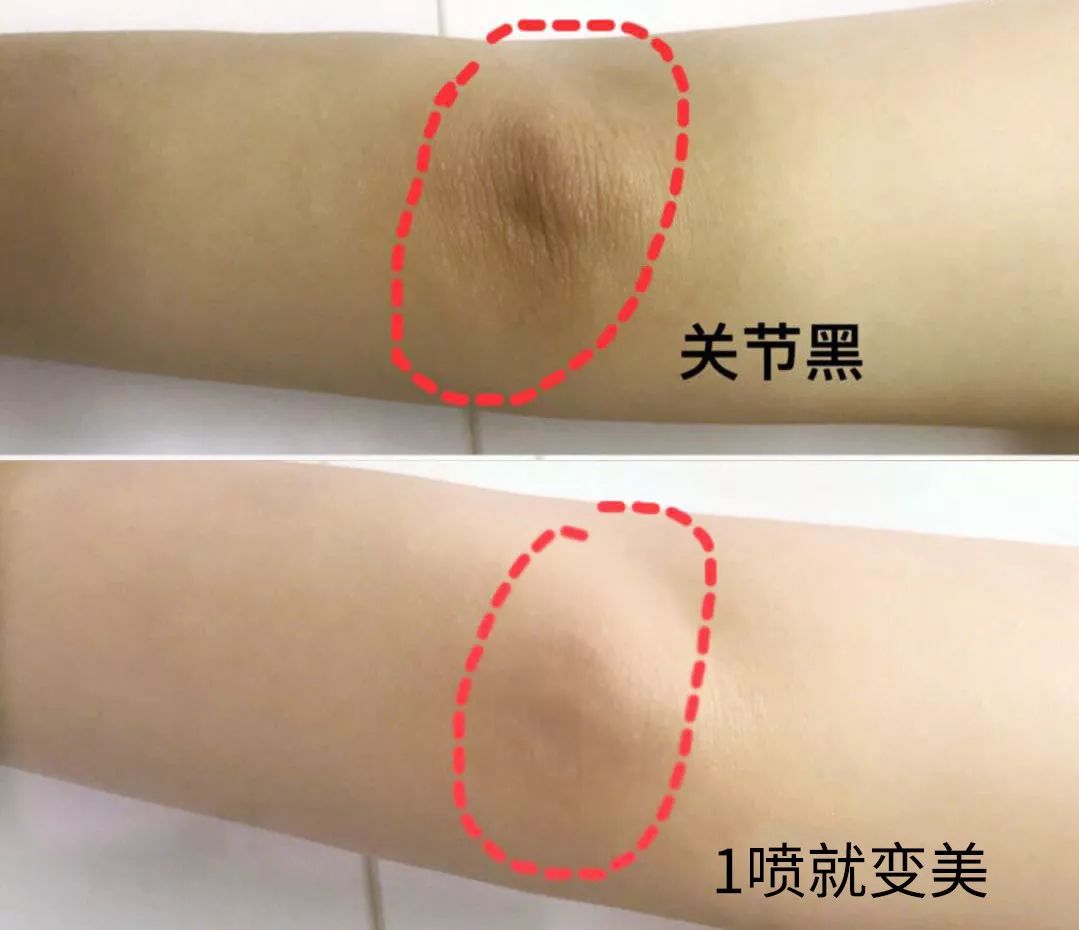 裸感美腿|1瓶=20双*袜丝**!3秒喷出“裸感”大美腿!隐形毛孔、鸡皮肤!短裙绝配