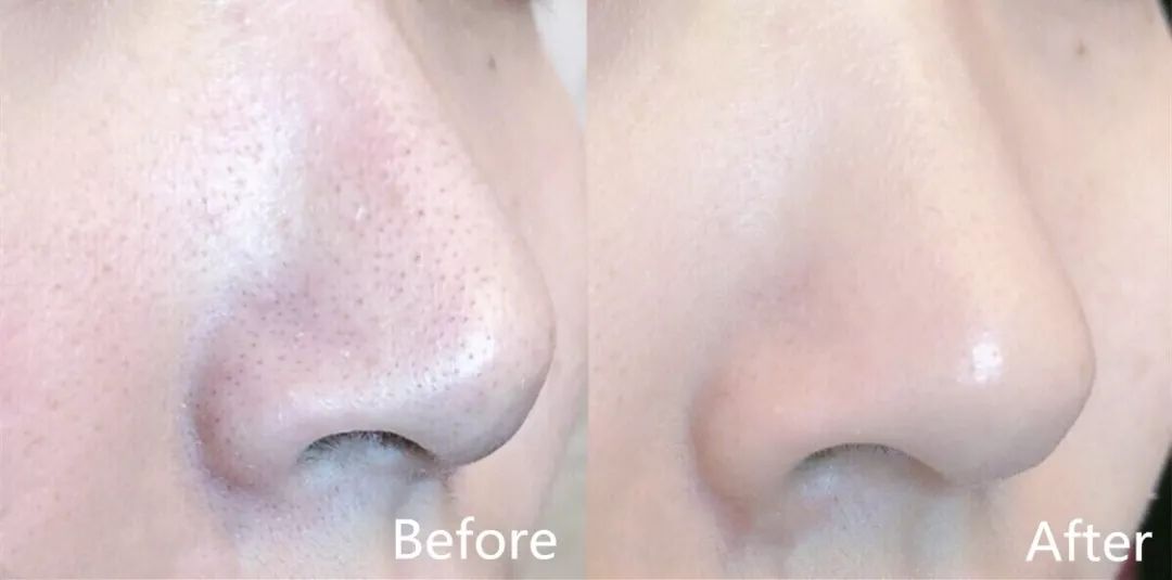 2019cosme面膜,韩国cosme大赏排名第一的补水面膜