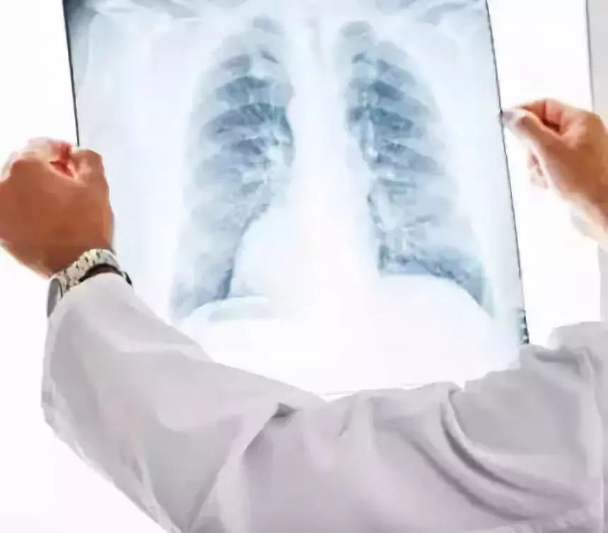 女童10岁骨龄12.5岁预测身高多少,8岁女孩骨龄提前2年