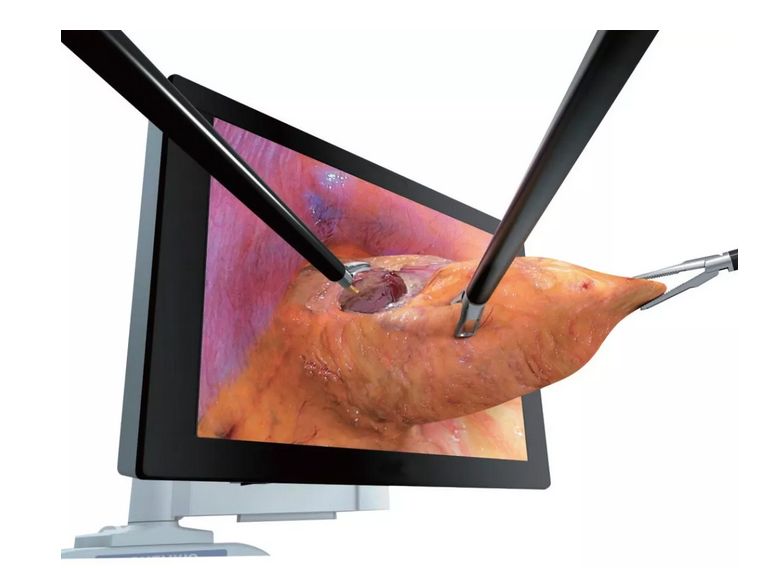 让无数女性尴尬的“社交癌”,医生戴着3D眼镜治好了!